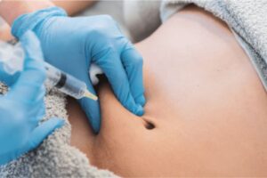 إبر إذابة الدهون