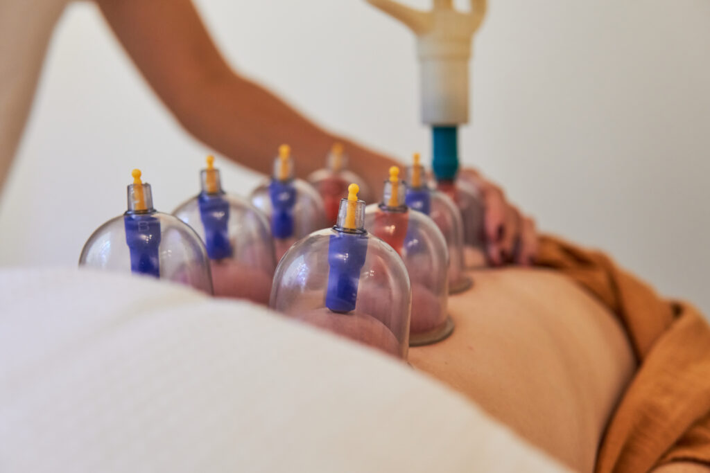 أدوات الحجامة المستخدمة في العلاج داخل مركز الدليل الطبي