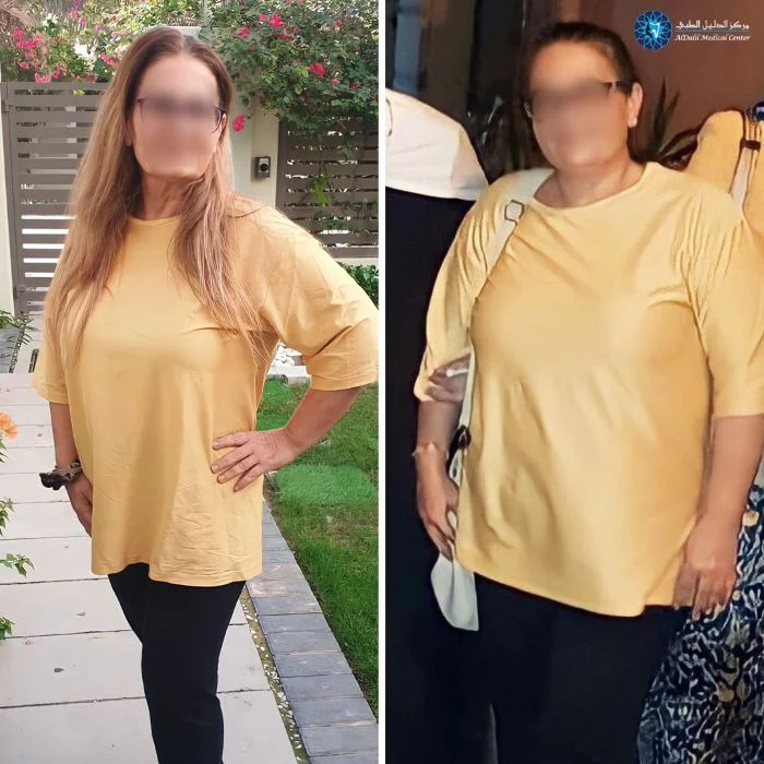 مركز نحت الجسم في الشارقة